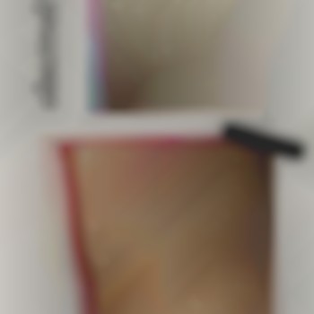 Електроепіляція бікіні класика.