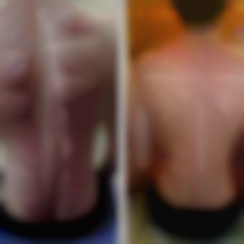 Масаж "Dr. Hill". Авторська методика
                    Масажний салон Dr. Hill Київ