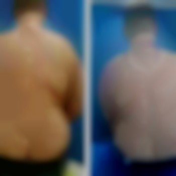 Масаж "Dr. Hill". Авторська методика
                    Масажний салон Dr. Hill Київ