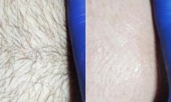 Шугаринг Майстер депіляції Катерина Вінниця