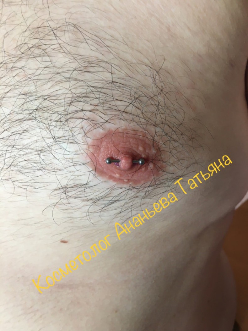 Пирсинг мужского соска #інтимнийпірсинг #пірсингсосків #пірсингсоска
 #мужскойпирсинг, фото - Майстер з пірсингу Тетяна Ананьєва