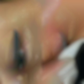 Клиента хочет удалить хвостики стрелочки. После 1 сеанса