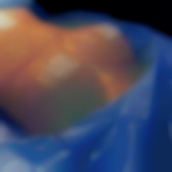 Маммопластика (увеличение груди)
                    Пластичний хірург Абдель Харків