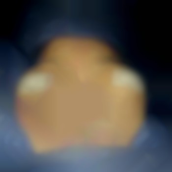 Маммопластика (увеличение груди)
                    Пластичний хірург Абдель Харків