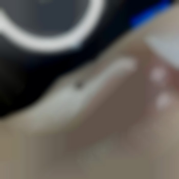 Бікіні після 2