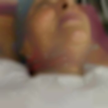 Корекція шиї