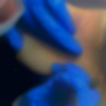 Електроепіляція глибокого бікіні
                    Електролог Яна Полтава