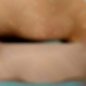 Після 3 процедур, фото - майстер депіляції Ірина Паламарчук