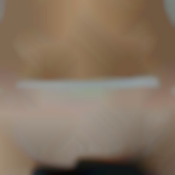 Після 3 процедур, фото - майстер депіляції Ірина Паламарчук