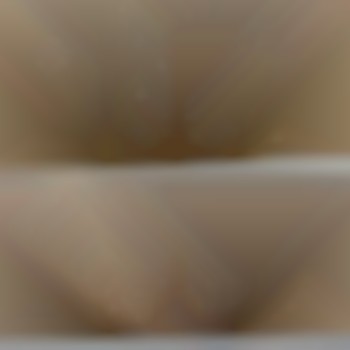 Лазерна Епіляція
                    Салон краси Laser Impuls Київ