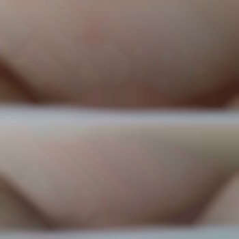 Лазерна Епіляція
                    Салон краси Laser Impuls Київ