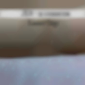 лазерна епіляція