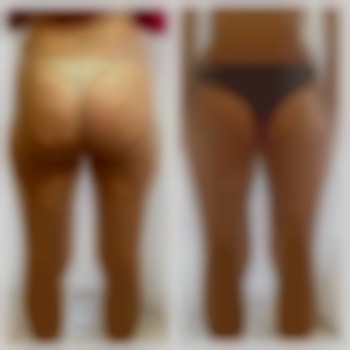 Корекція фігури