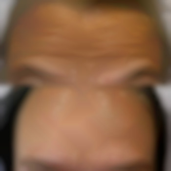 Фото з портфоліо косметолога Лілія Миколаївна (Київ)