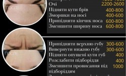 Ботокс! Академмістечко! Салон краси Jazz Київ