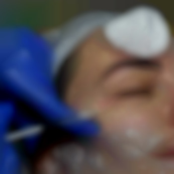 Біоревіталізація -зволоження шкіри обличчя та тіла
                    Косметолог Елена Одеса