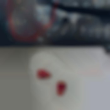 Видалення зубів
                    Стоматолог Іван Львів