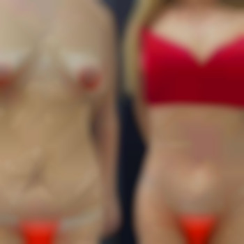 Абдель Эрритали, Харків Фото - 69