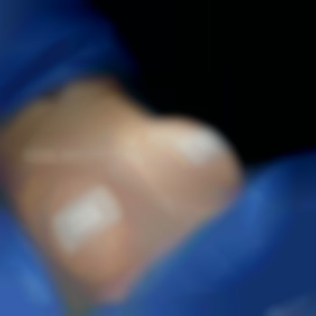 Абдель Эрритали, Харків Фото - 57