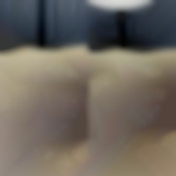 Зменшення густини волосся за 1 процедуру