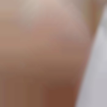 Лобок після 5 процедур