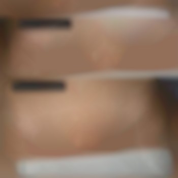 Анна Щербина, Дніпрорудне Фото - 3