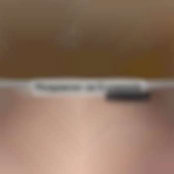 Анна Щербина, Дніпрорудне Фото - 4