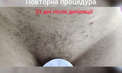Депіляція воскова Майстер воскової депіляції  Суми