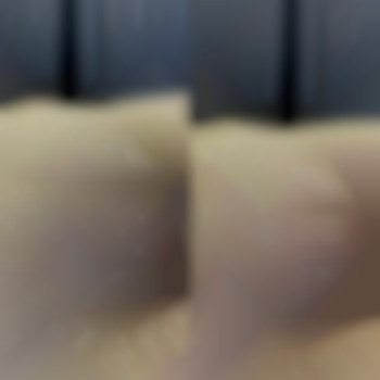 Воскова депіляція
                    Майстер воскової депіляції  Біла Церква