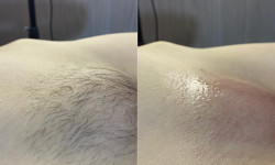 Глибоке бікіні Майстер воскової депіляції  Біла Церква