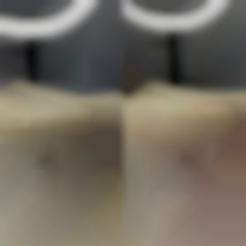 Глибоке бікіні
                    Майстер воскової депіляції  Біла Церква