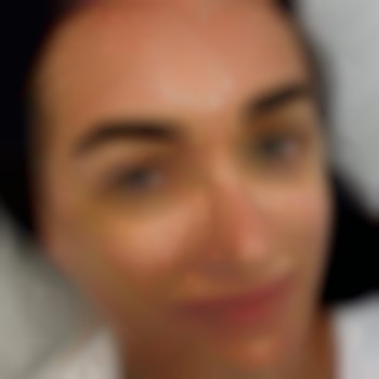 Волоскова техніка після процедури