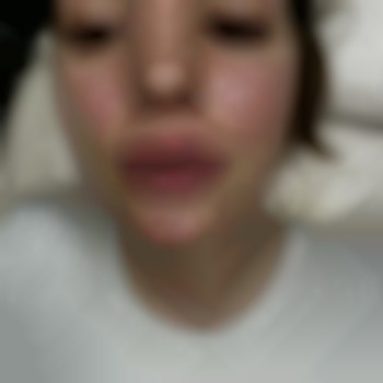  #збільшення губ Київ