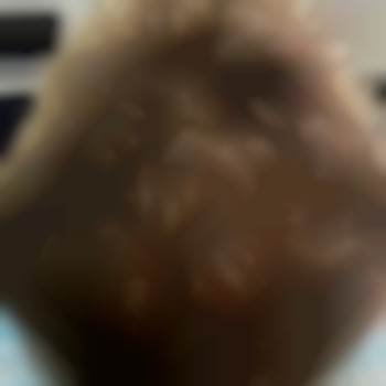 Трихопігментація