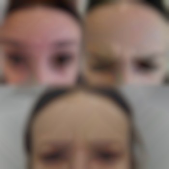 Результат вже на 4 день.