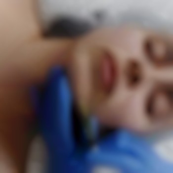 уколи ботокса для обличчя, корекціяз моршок, уколи в обличчя