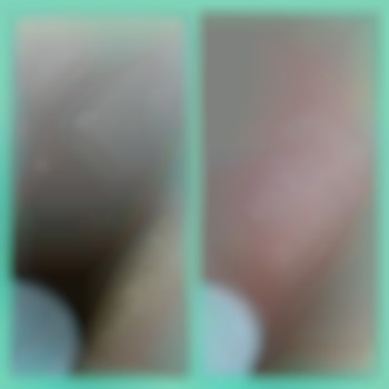 Депіляція бікіні воском, фото - майстер з пірсингу Тетяна Ананьєва