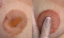 Татуж ареол, естетичний татуаж Майстер перманентного макіяжу Наталия Ивановна Київ