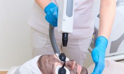 Карбоновий пілінг Майстер перманентного макіяжу Виталина Київ