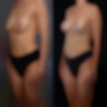 Денис Юрченко , Буковель Фото - 3