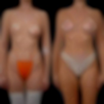 Денис Юрченко , Буковель Фото - 6