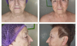 Векторный массаж лица Масажист Наталія Одеса