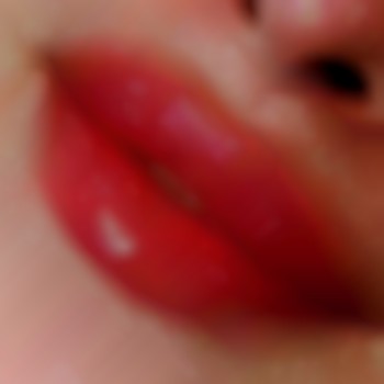 1мл філлера