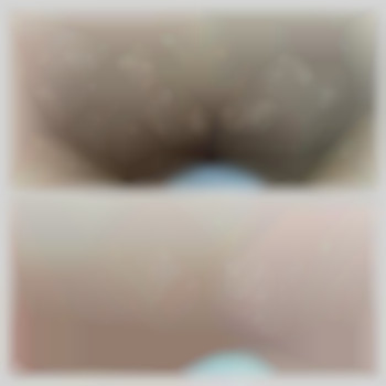 Депіляція зони глибокого бікіні, фото - майстер з пірсингу Тетяна Ананьєва