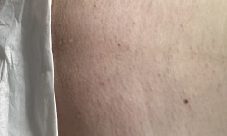 Глибоке бікіні Майстер депіляції Світлана Луцьк