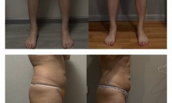 Моделирующий массаж Мануальний терапевт Виктория Київ