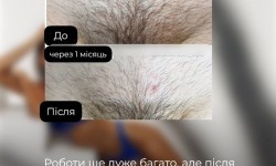  Майстер депіляції  Київ
