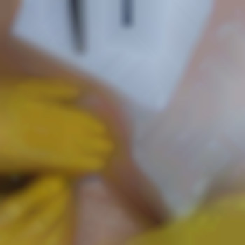 Косметологічна чистка бікіні від врослого волосся
                    Майстер шугарингу  Кам'янське