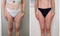 Вибромасаж Масажний салон Студия аппаратних массажей Studio 18 Дніпро