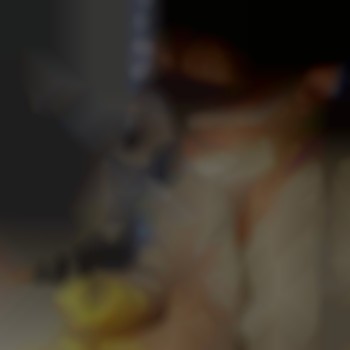 Електроепіляція